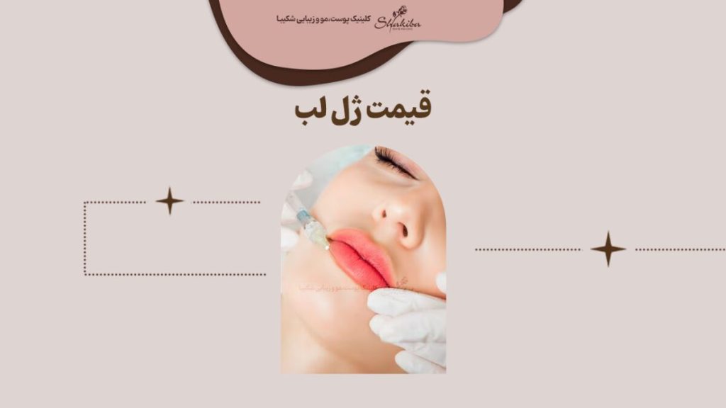 قیمت ژل لب 1402