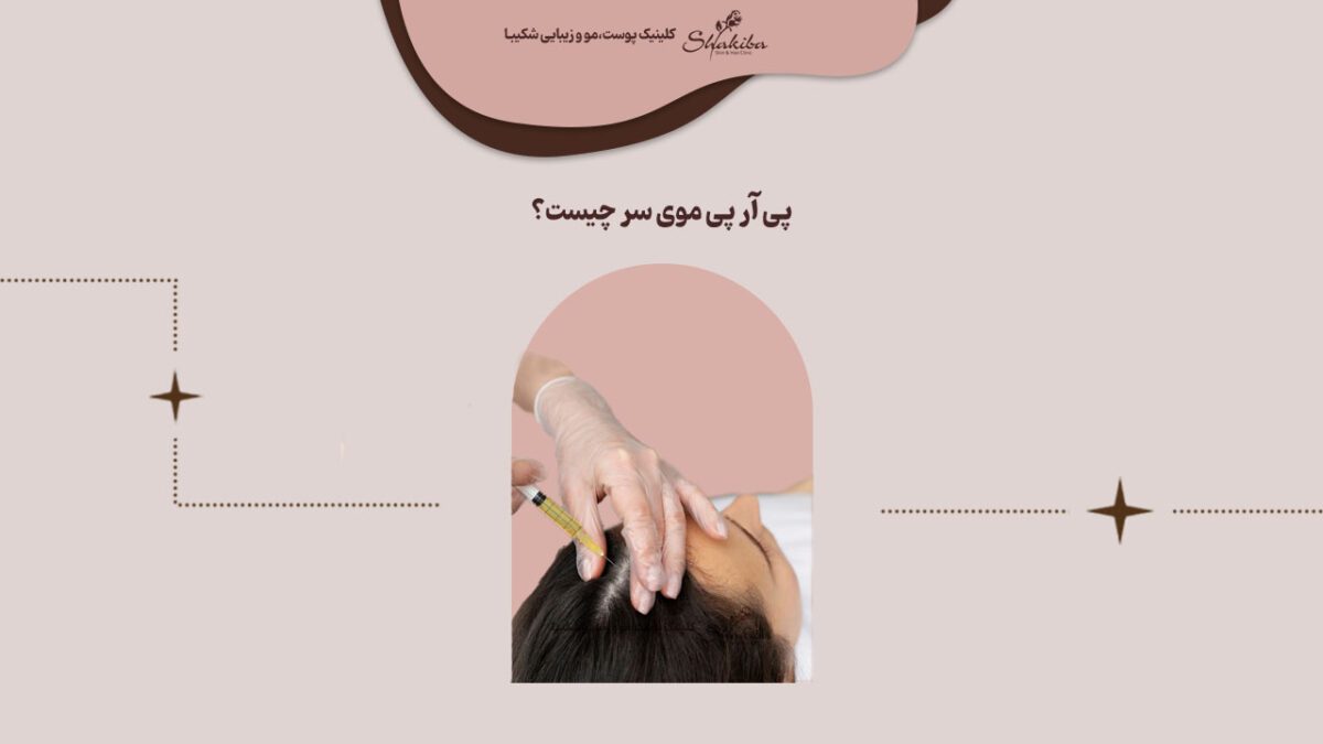 پی آر پی مو چیست