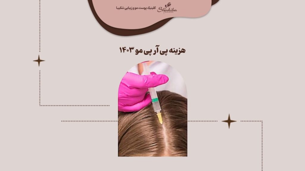 قیمت پی ار پی مو