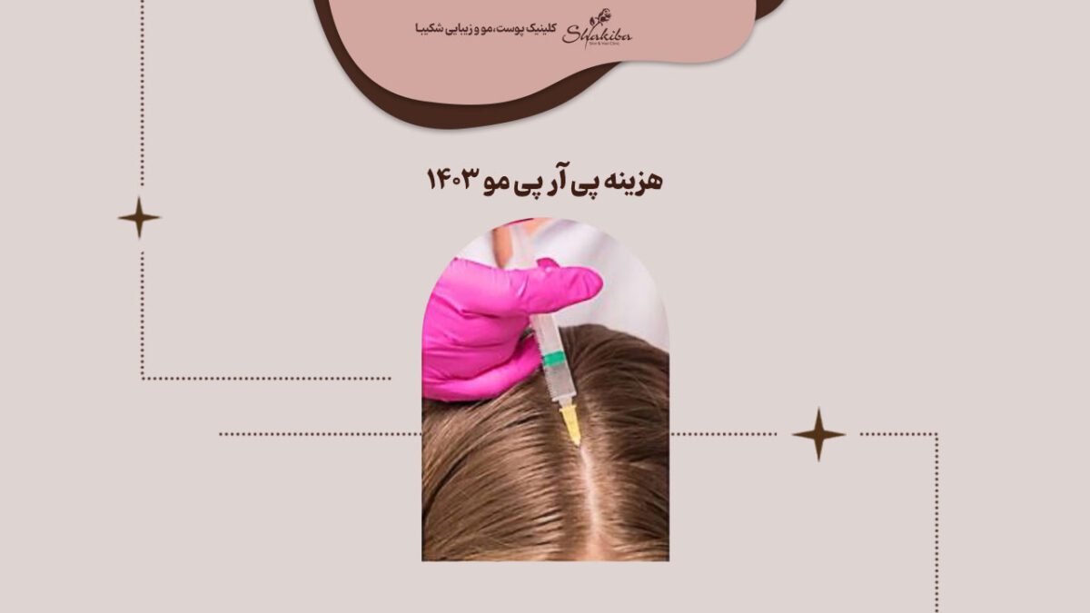 قیمت پی ار پی مو