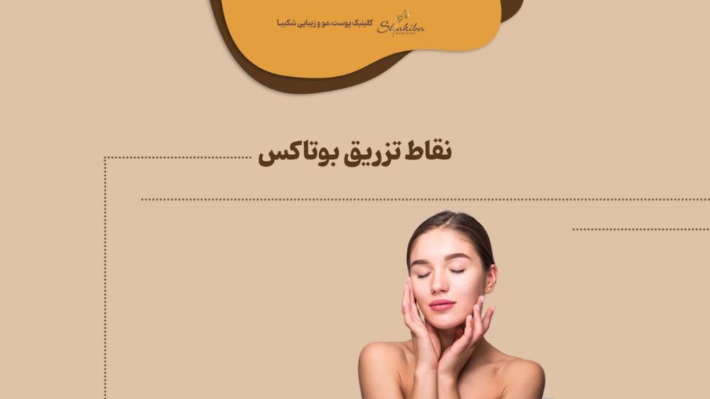 نقاط تزریق بوتاکس