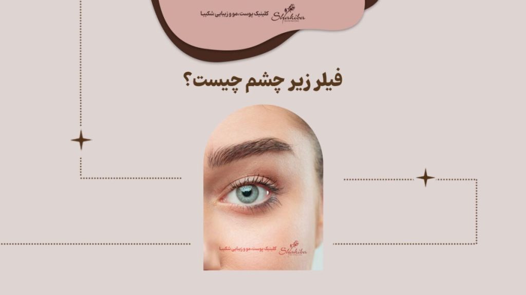 فیلر زیر چشم چیست