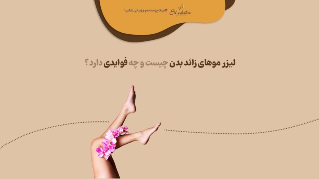 لیزر موهای زائد بدن