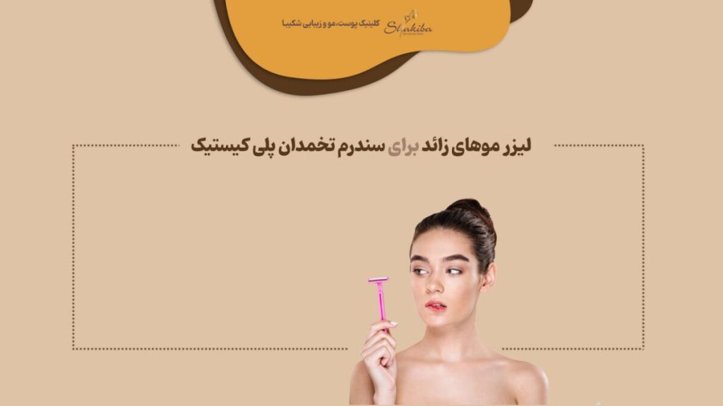 لیزر موهای زائد برای سندرم تخمدان پلی کیستیک