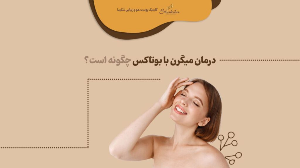 درمان میگرن با بوتاکس