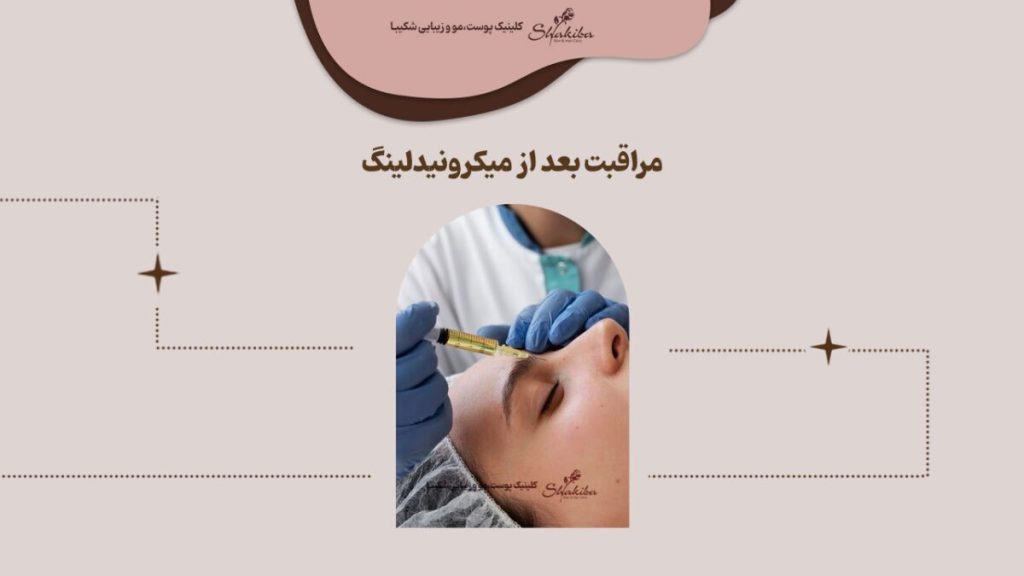 نکات مراقبت بعد از میکرونیدلینگ