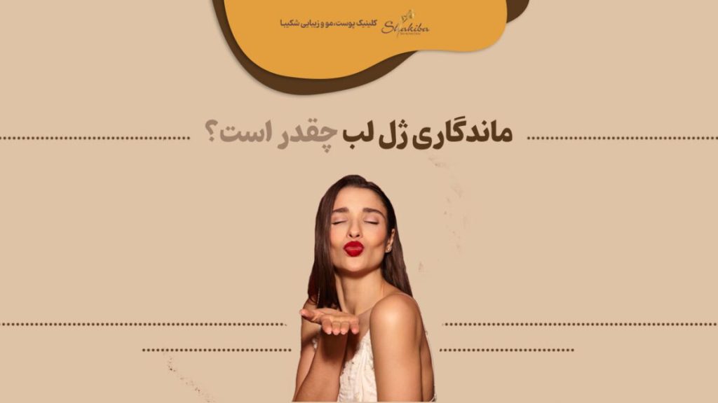 ماندگاری ژل لب