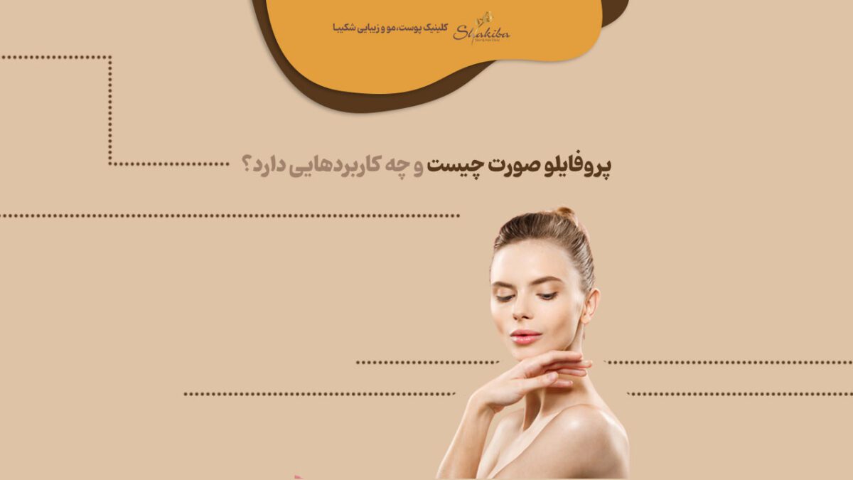 پروفایلو صورت چیست