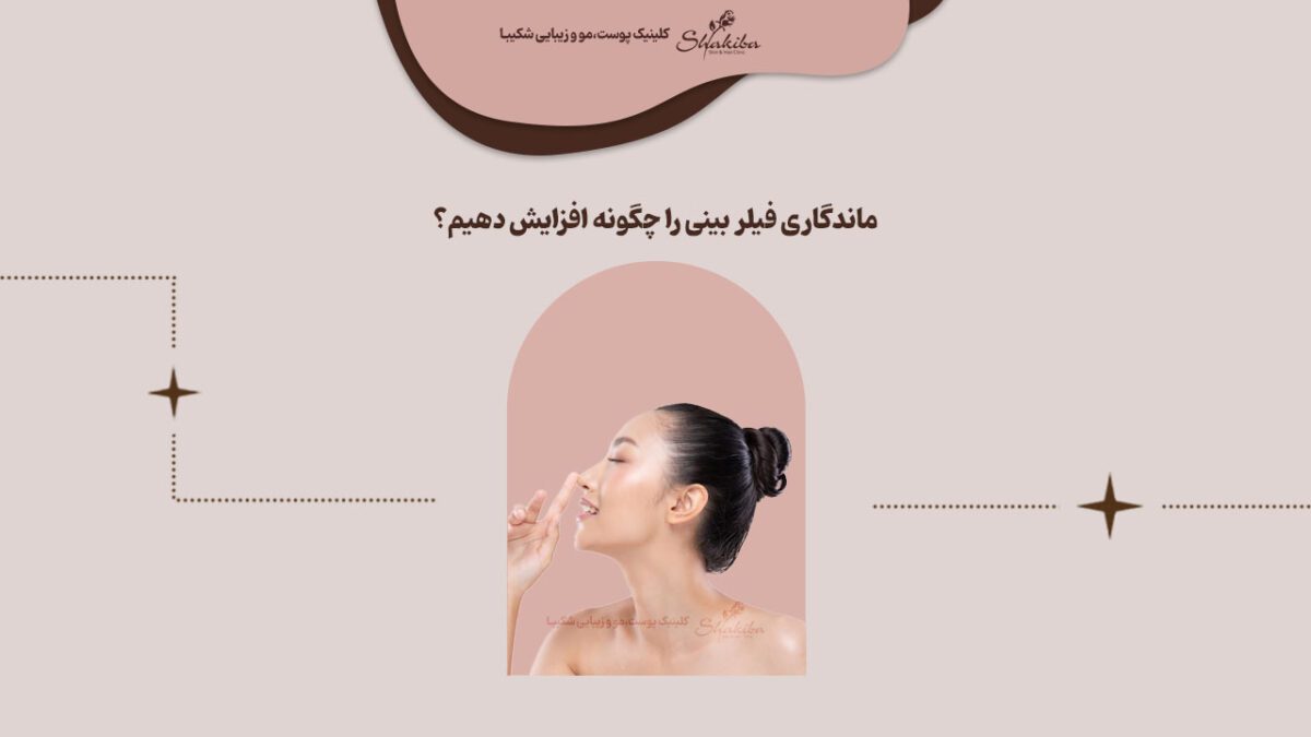 ماندگاری فیلر بینی چقدره؟