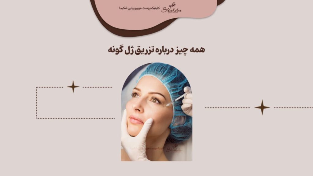 تزریق ژل گونه