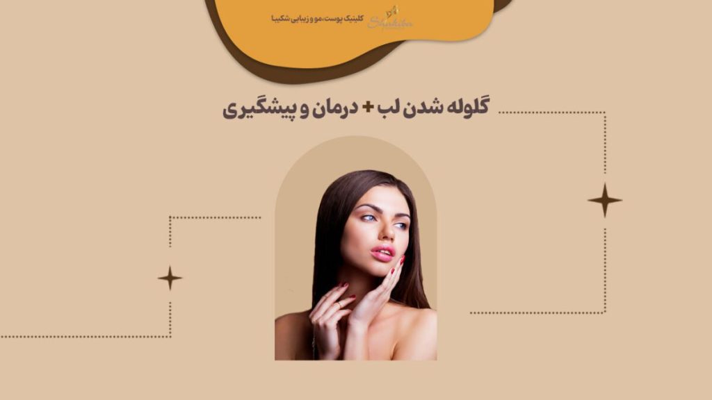 گلوله شدن ژل لب
