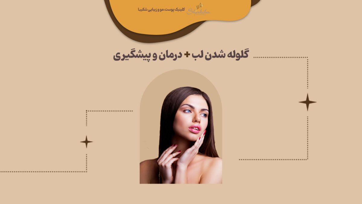 گلوله شدن ژل لب