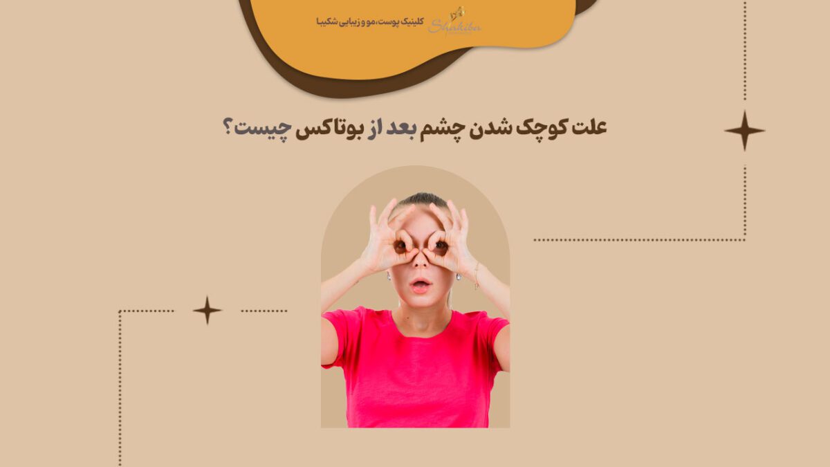 علت کوچک شدن چشم در اثر بوتاکس