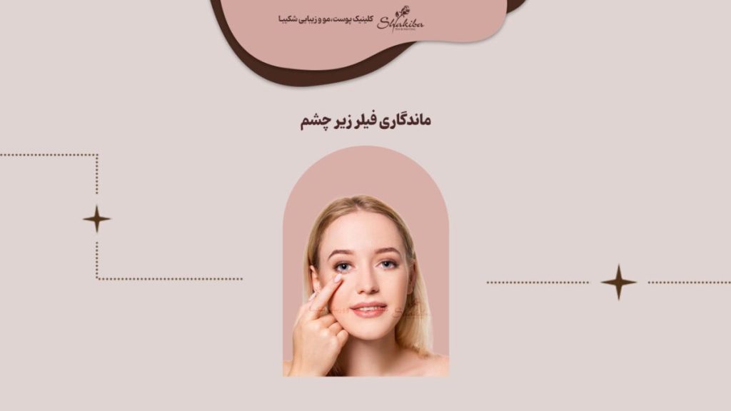 ماندگاری فیلر زیر چشم