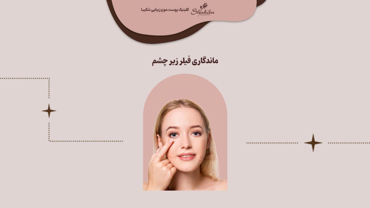 ماندگاری فیلر زیر چشم