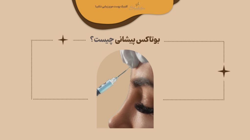 بوتاکس پیشانی