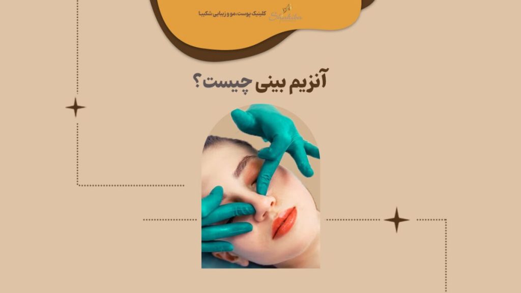 آنزیم بینی چیست