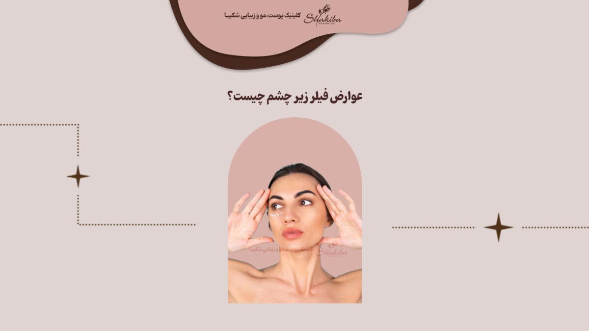 عوارض فیلر زیر چشم