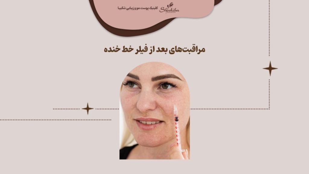 مراقبتهای بعد از فیلر خط خنده