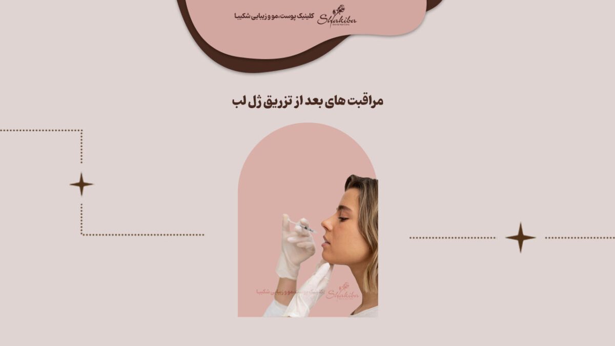 نکات مراقبت های بعد از تزریق ژل لب