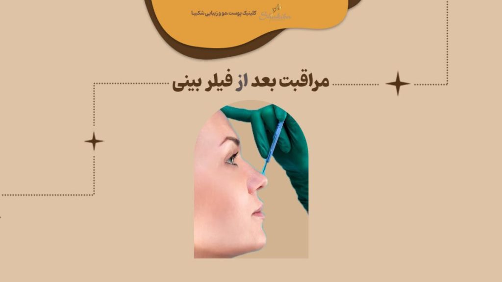 مراقبت بعد از فیلر بینی