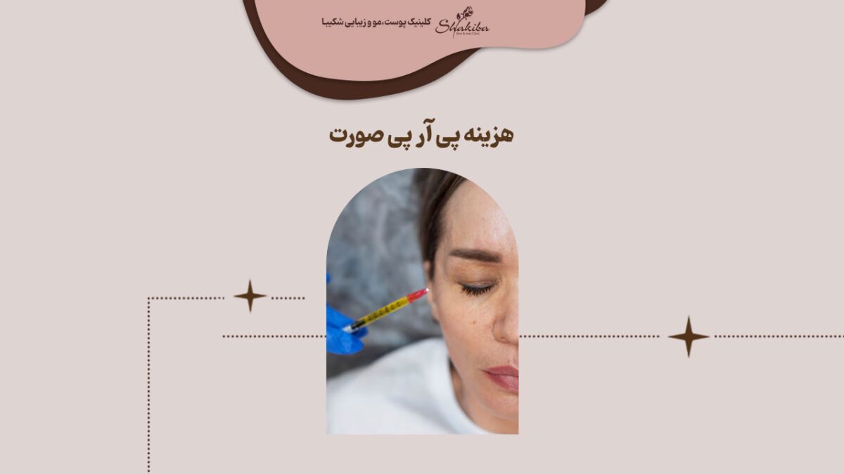 هزینه پی آر پی صورت