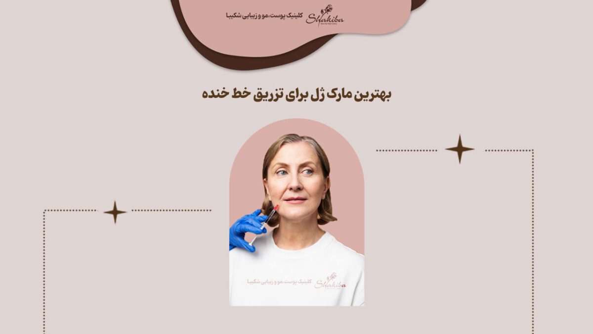 بهترین مارک ژل برای تزریق خط خنده