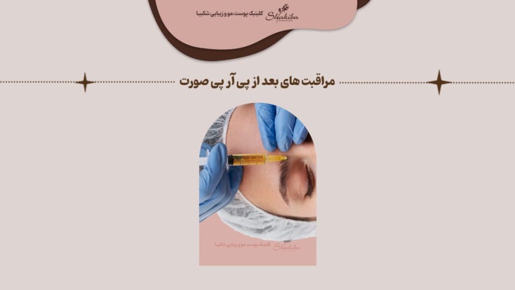 مراقبت های بعد از پی آر پی صورت چیست