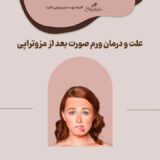 علت و درمان ورم صورت بعد از مزوتراپی