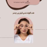 علت گلوله شدن فیلر زیر چشم