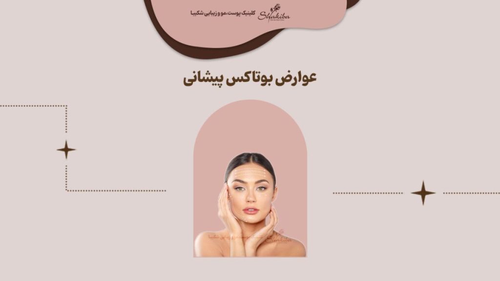 عوارض بوتاکس پیشانی