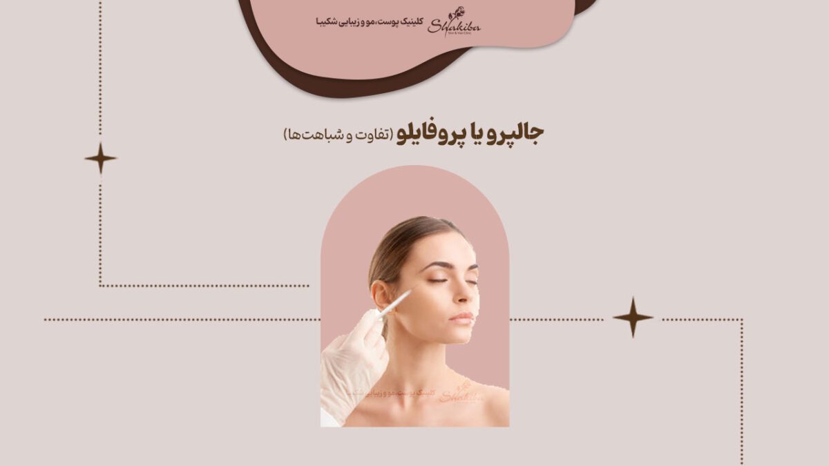 جالپرو یا پروفایلو