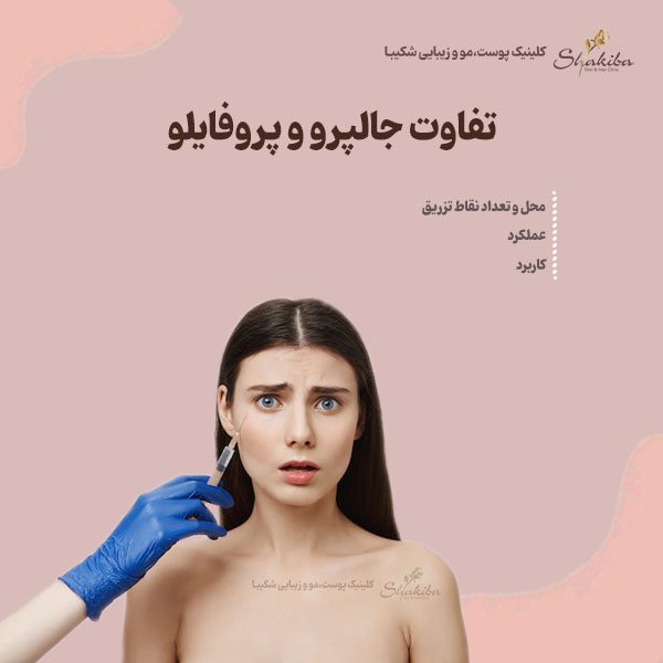 تفاوت جالپرو و پروفایلو در چیست