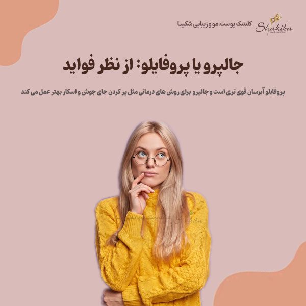 جالپرو یا پروفایلو