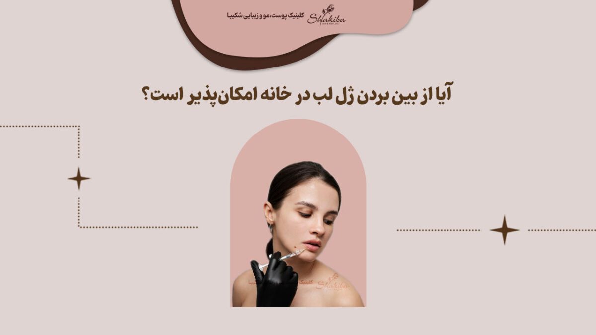 روش از بین بردن ژل لب در خانه