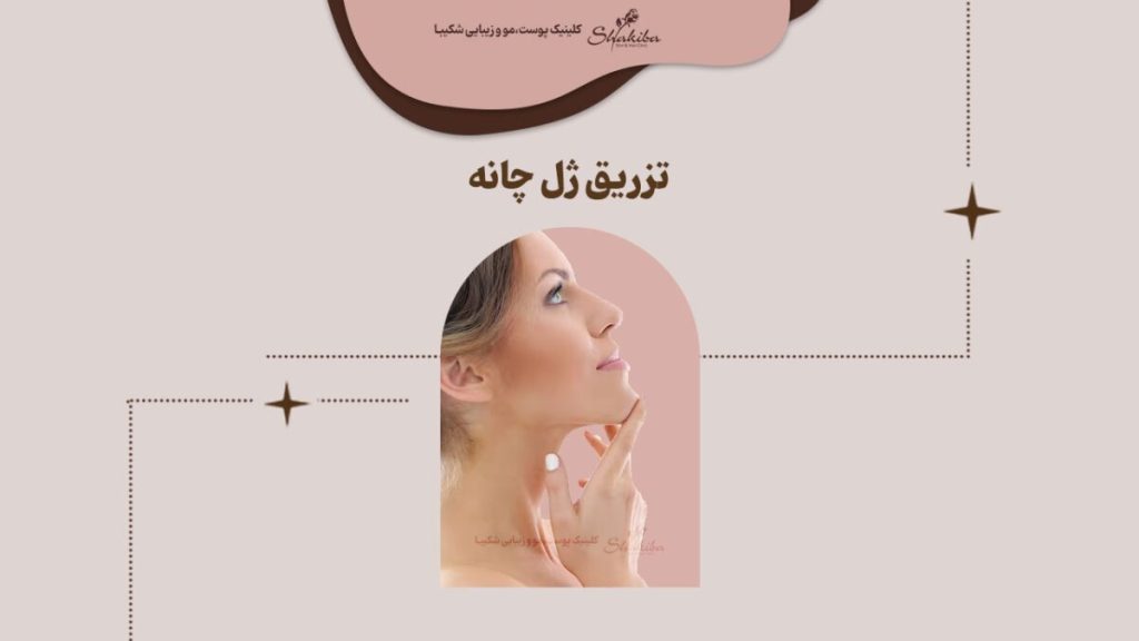 تزریق ژل چانه
