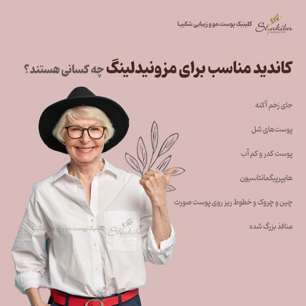 کاندیدای مزونیدلینگ صورت