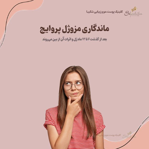 ماندگاری مزوژل پروایج