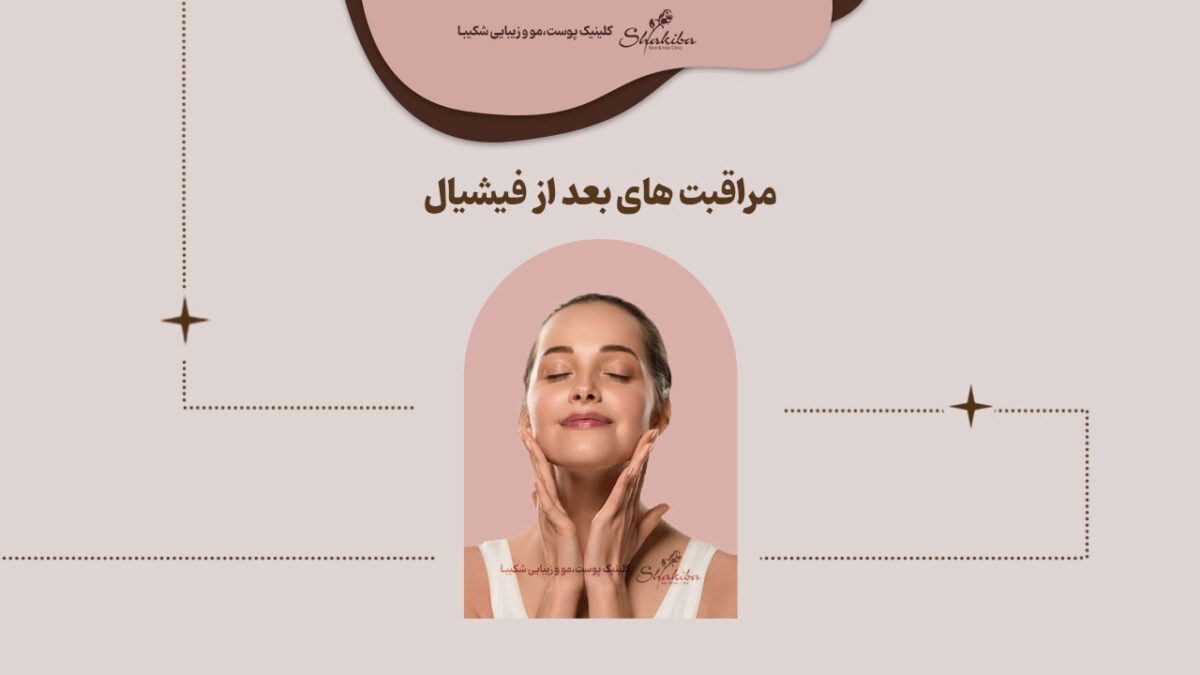 مراقبت های بعد از فیشیال صورت