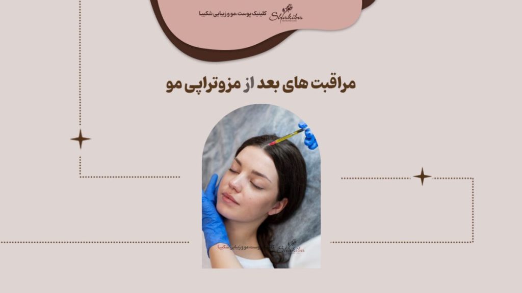 مراقبت بعد از مزوتراپی مو