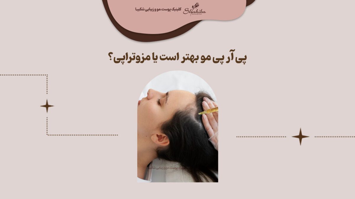 پی آر پی مو بهتر است یا مزوتراپی
