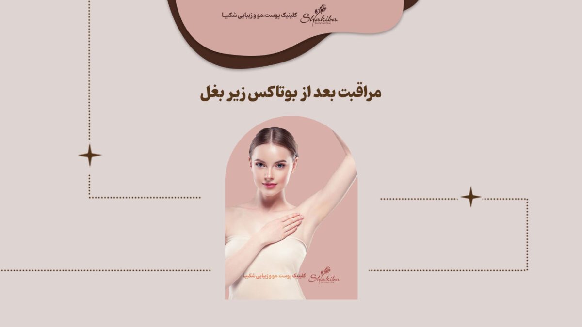 مراقبت های بعد از بوتاکس زیر بغل