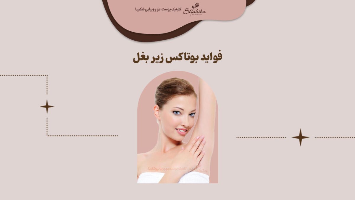 فواید بوتاکس زیر بغل چیست