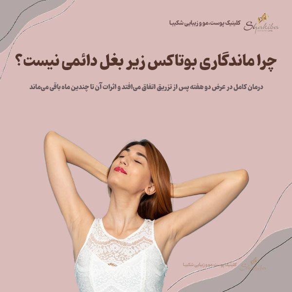 ماندگاری بوتاکس زیر بغل