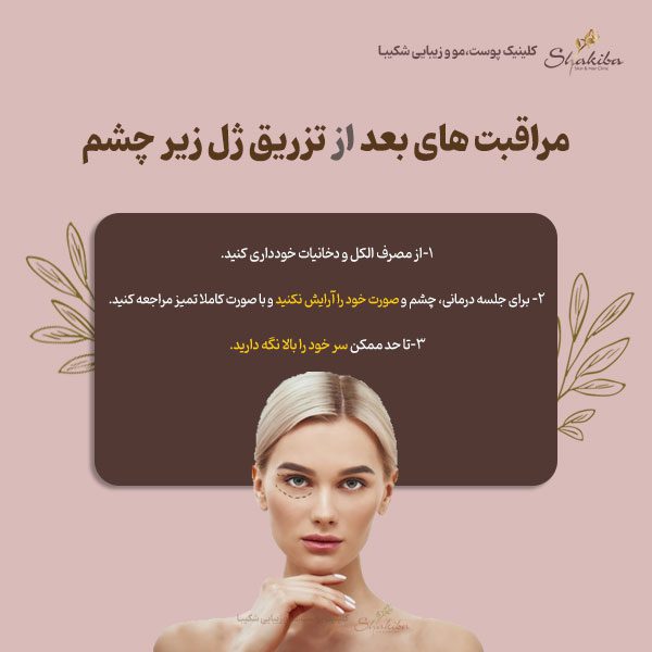 مراقبت های بعد از تزریق ژل زیر چشم