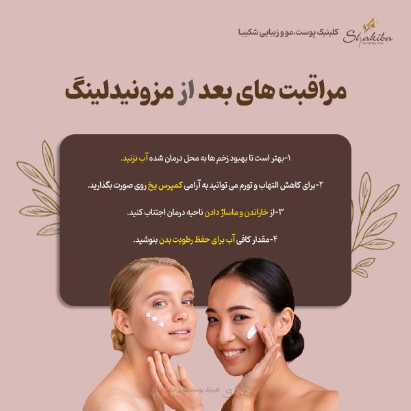 مراقبت های بعد از مزونیدلینگ