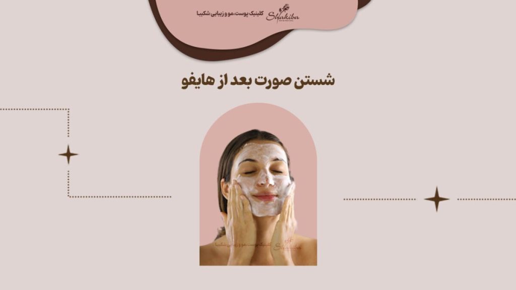 نحوه شستن صورت بعد از هایفو