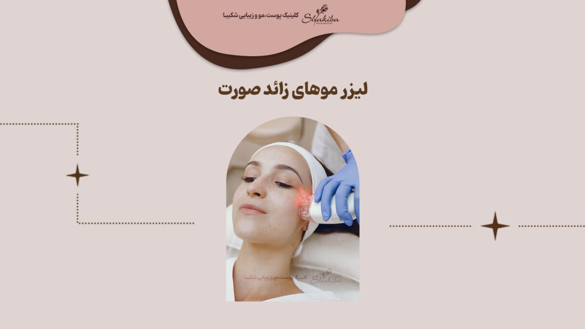 لیزر موهای زائد صورت
