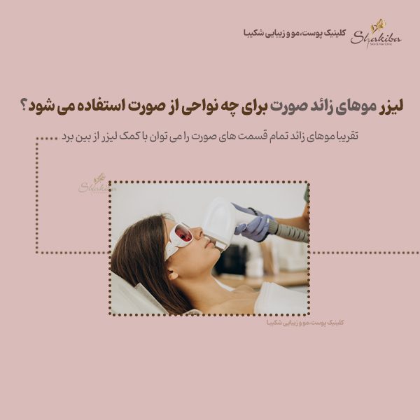 لیزر موهای زائد صورت