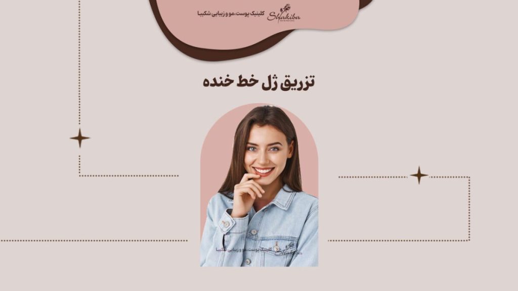 تزریق ژل خط خنده